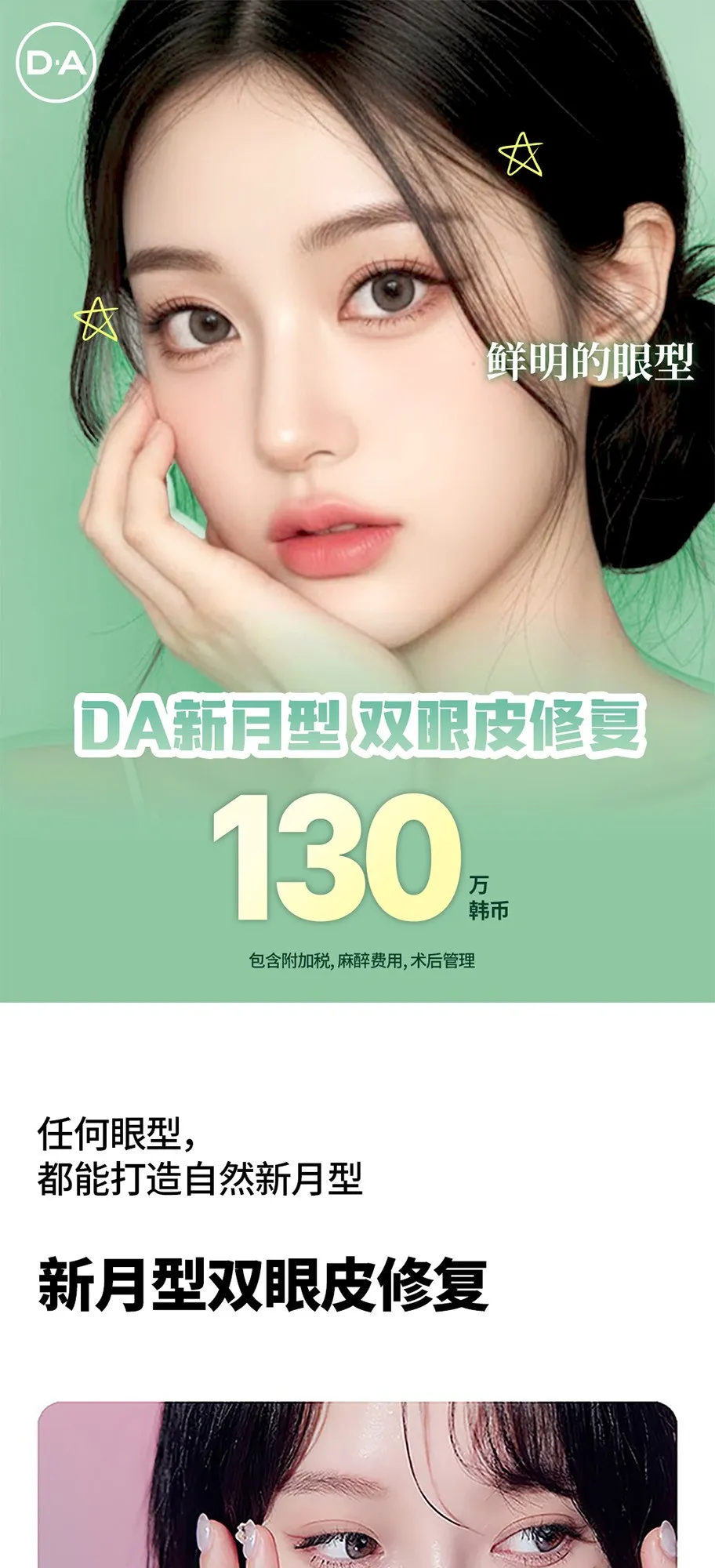 20260626_세미아웃눈재수술_강남언니_컨텐츠_중문 (1/8)