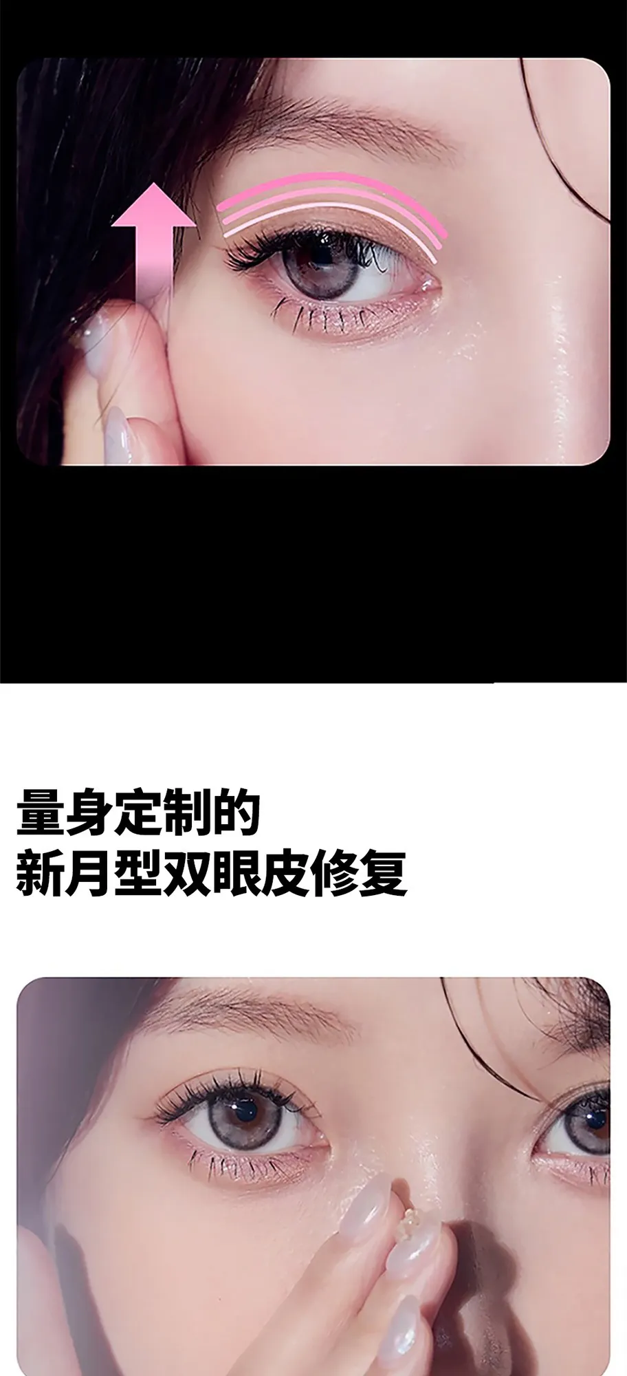 20260626_세미아웃눈재수술_강남언니_컨텐츠_중문 (6/8)