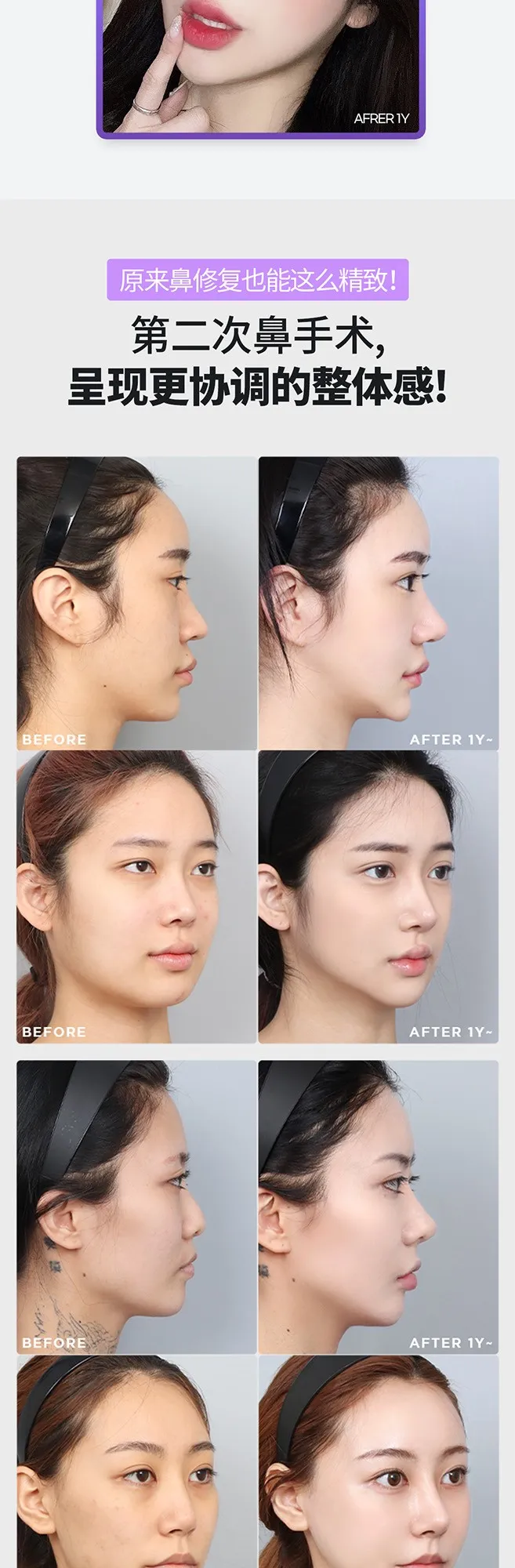 20260623_DA코재수술_중문 (2/8)