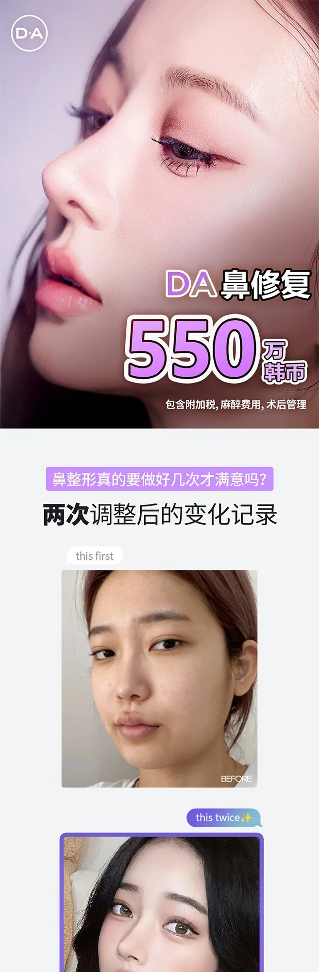 20260623_DA코재수술_중문 (1/8)