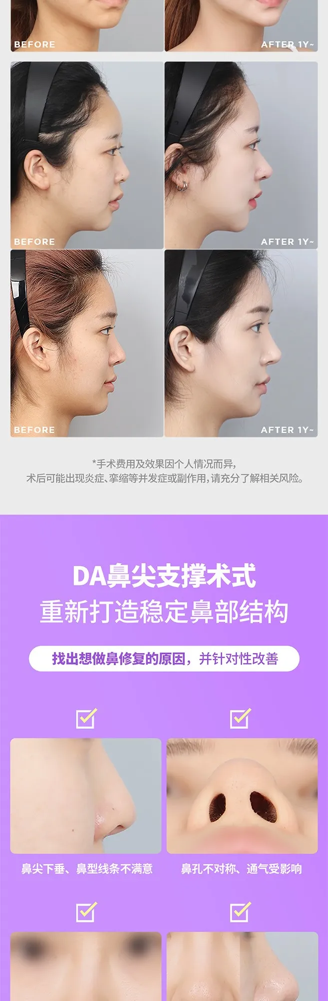 20260623_DA코재수술_중문 (3/8)