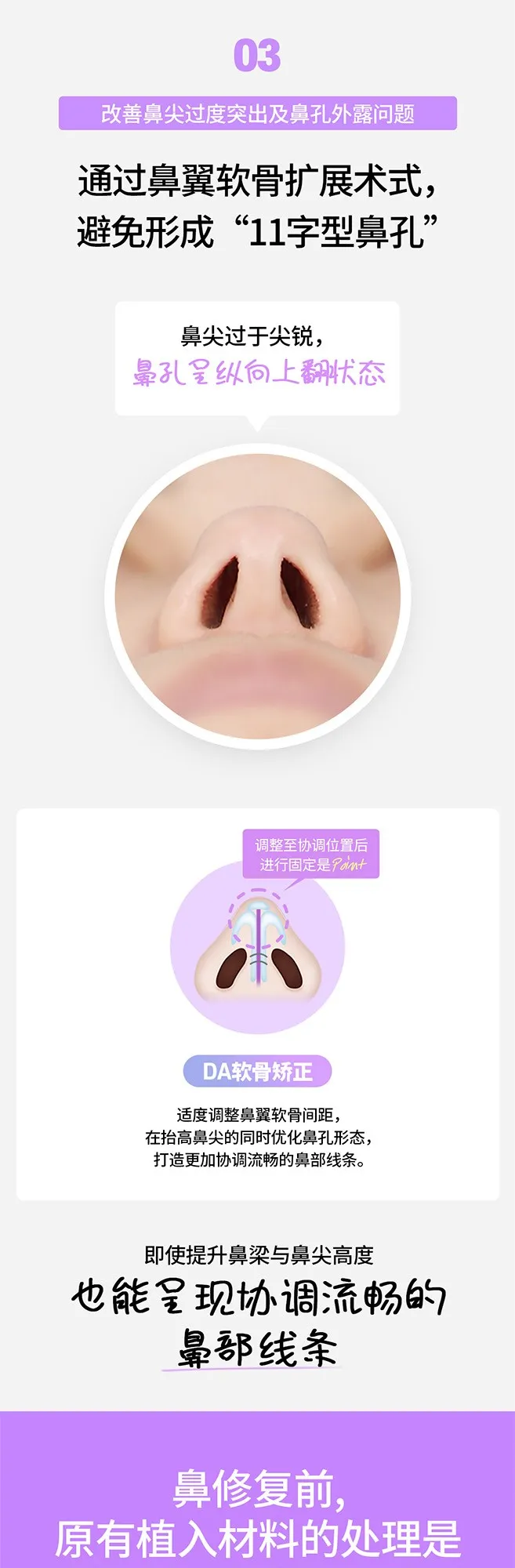 20260623_DA코재수술_중문 (6/8)