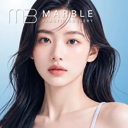 Full-Face Thread lift