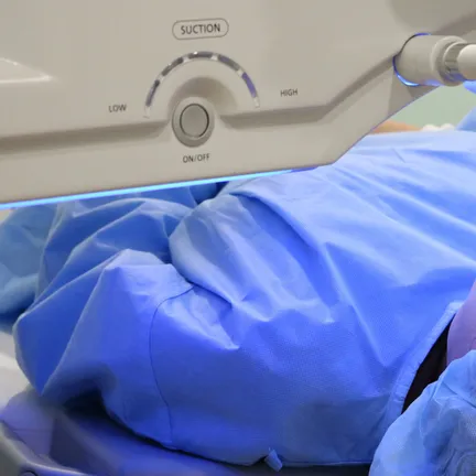 Lens Implantation Surgery