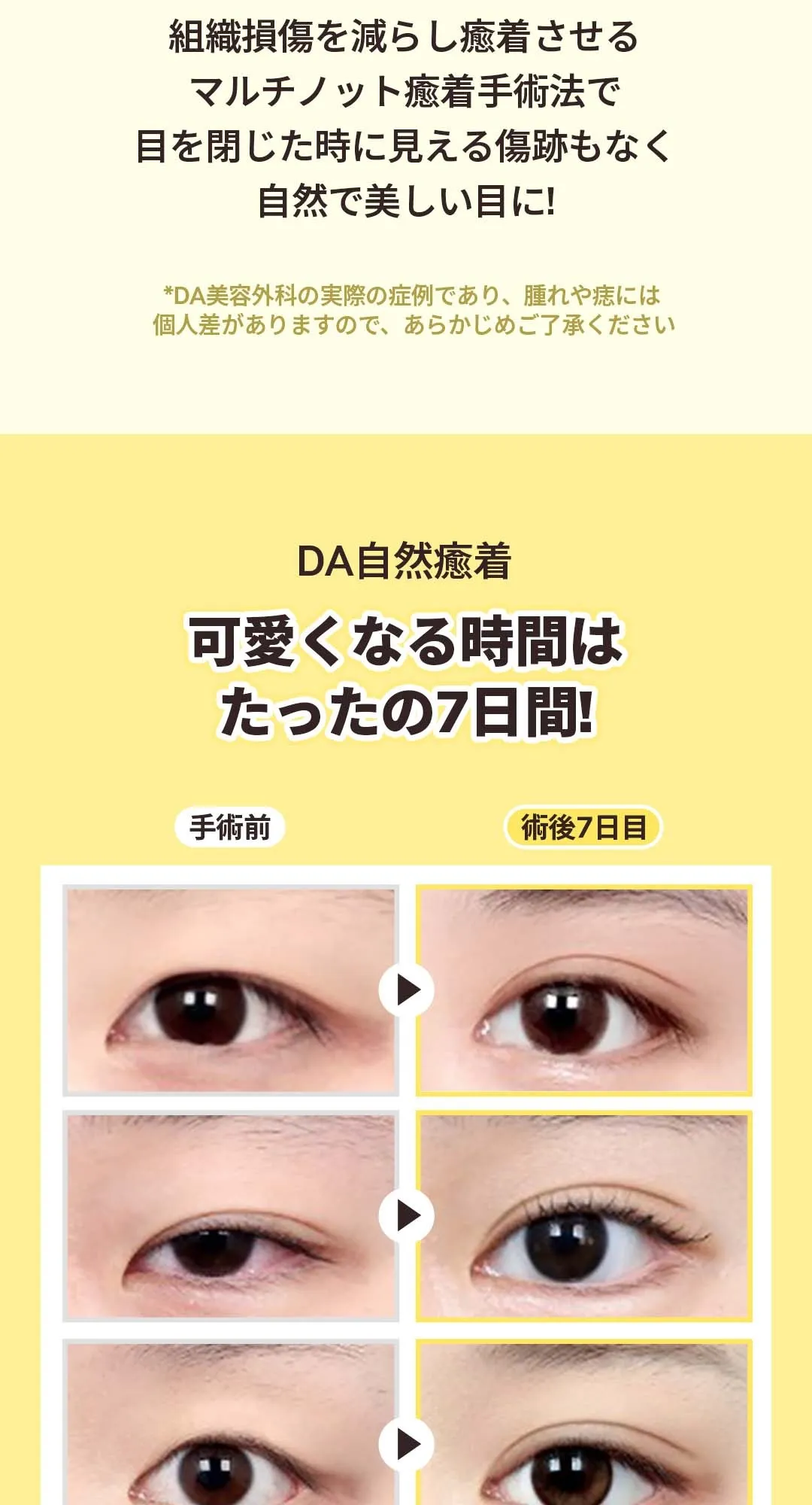 20260330_DA눈성형 (5/9)
