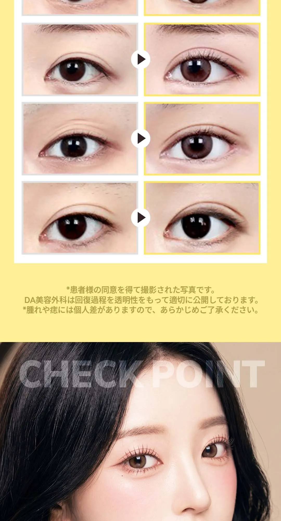 20260330_DA눈성형 (6/9)