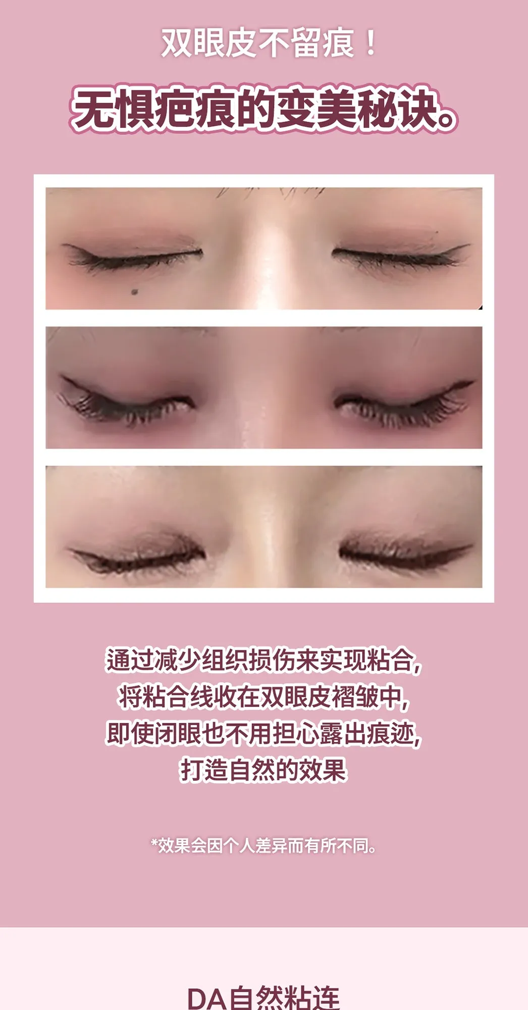 20260623_DA눈성형_중문 (4/8)