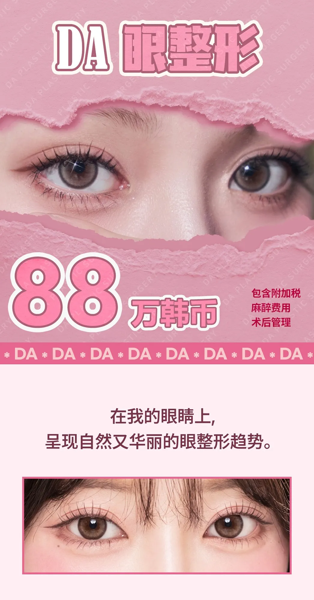 20260623_DA눈성형_중문 (1/8)