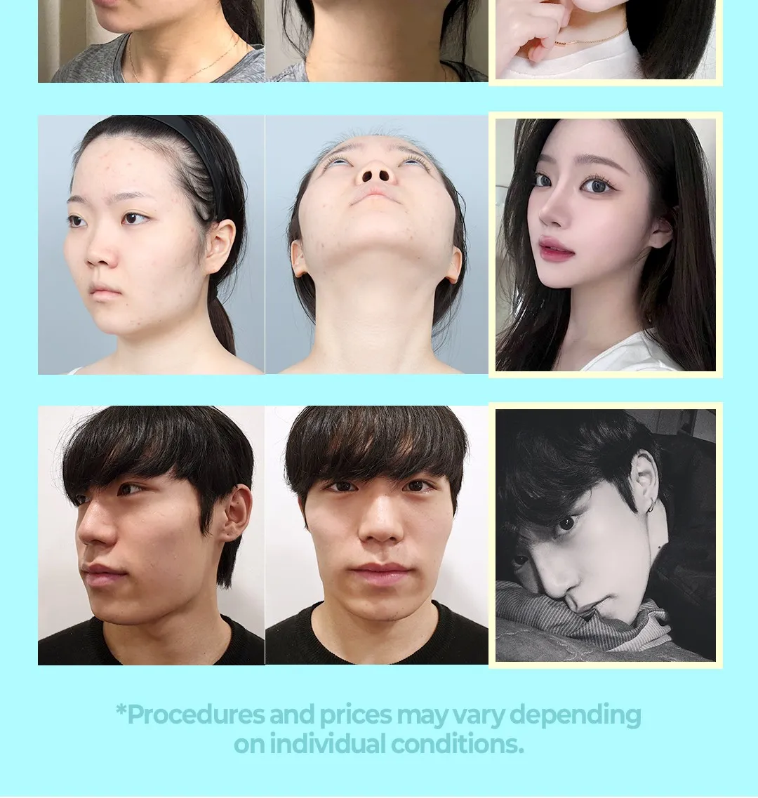 20260320_DA윤곽3종 (6/6)