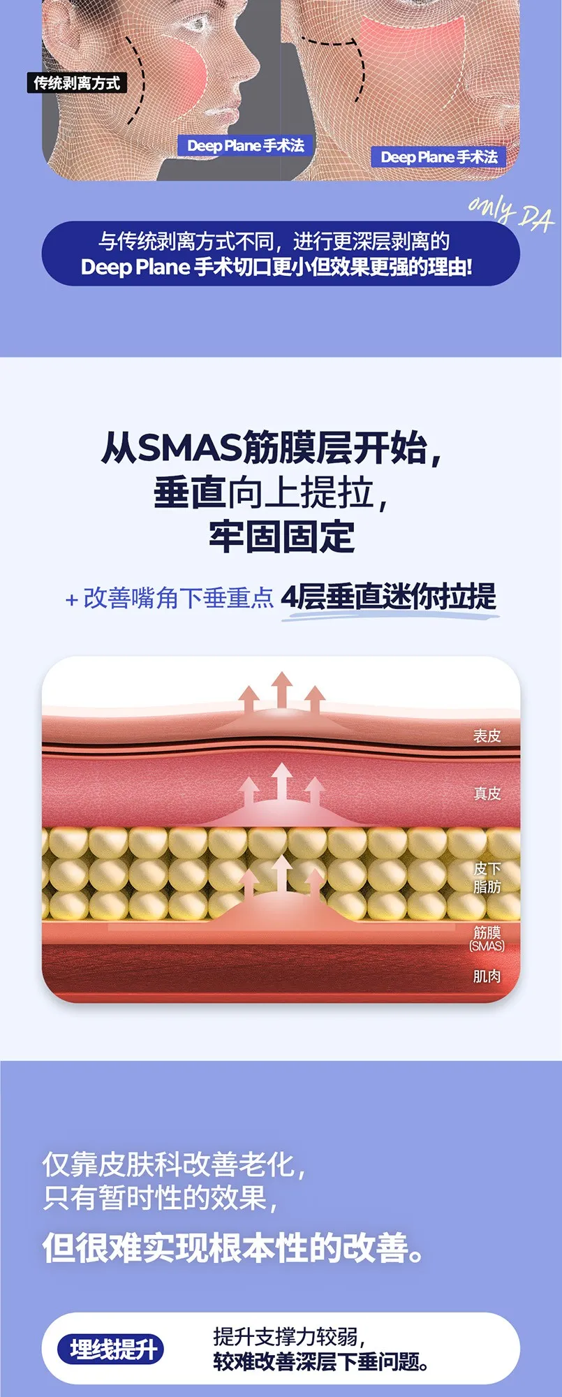 20260624_수직미니거상_강남언니_컨텐츠_중문 (6/8)