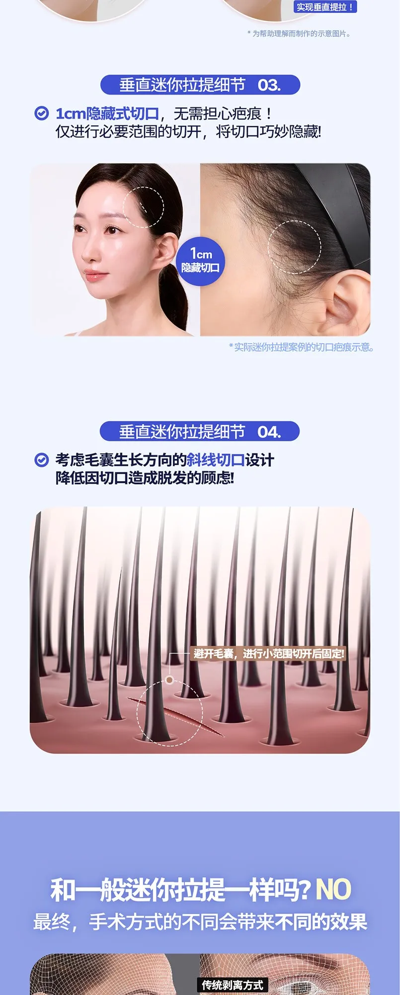 20260624_수직미니거상_강남언니_컨텐츠_중문 (5/8)