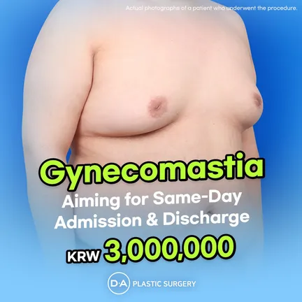 Breast Reduction