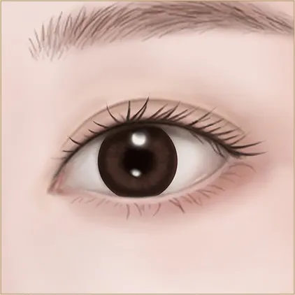 Under-eye fat 3