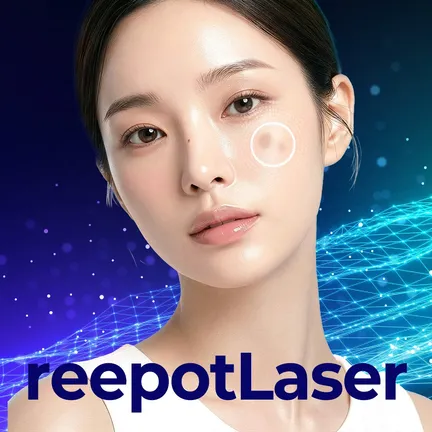 Pigmentation Laser
