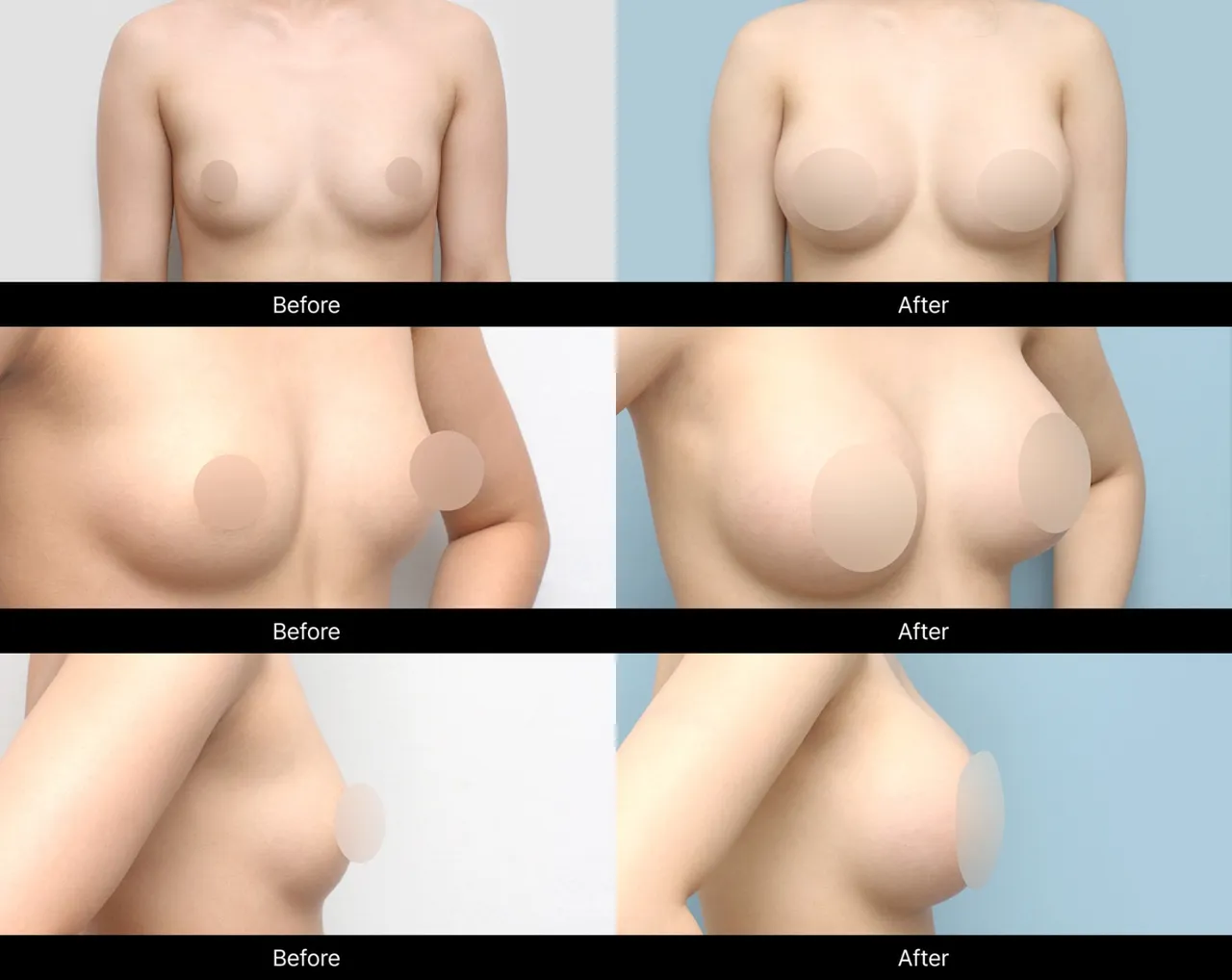 Mentor before-and-after images