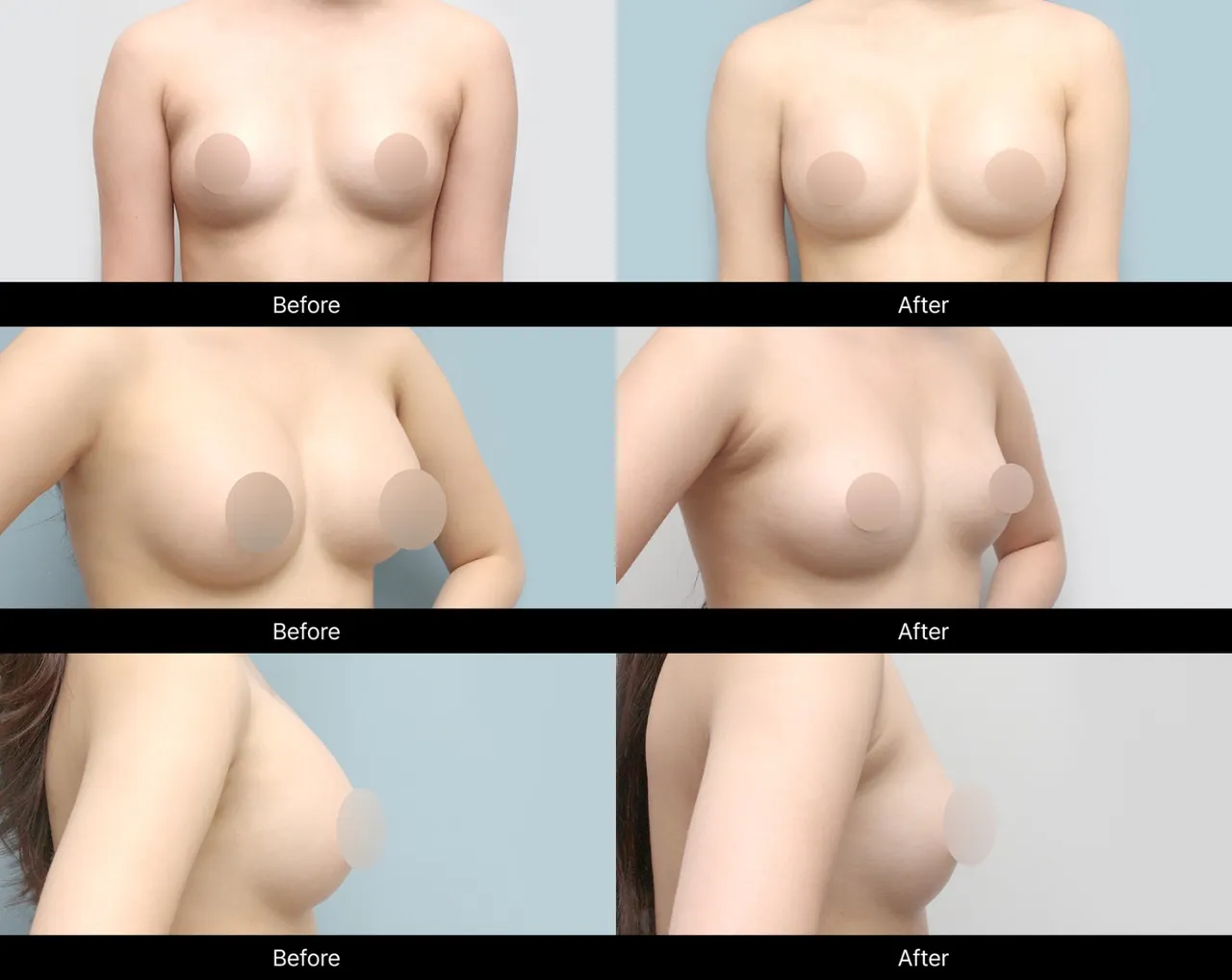 Sebbin before-and-after image