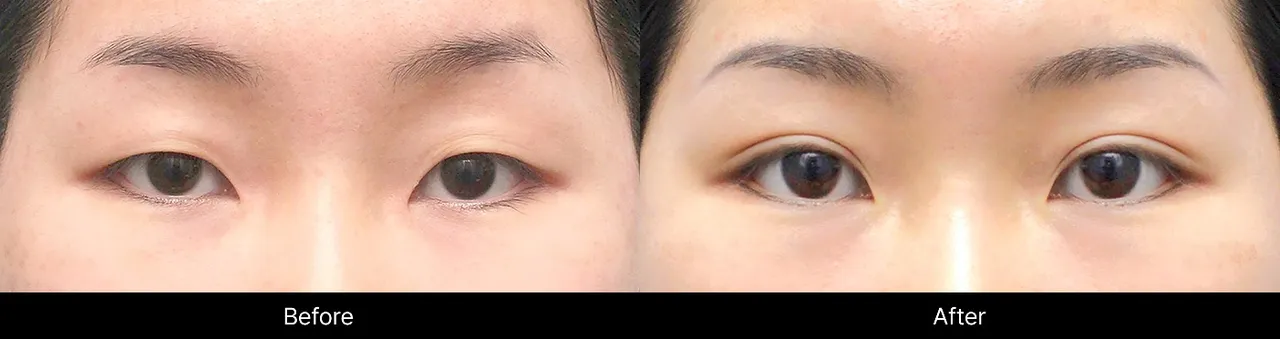 Before and after image