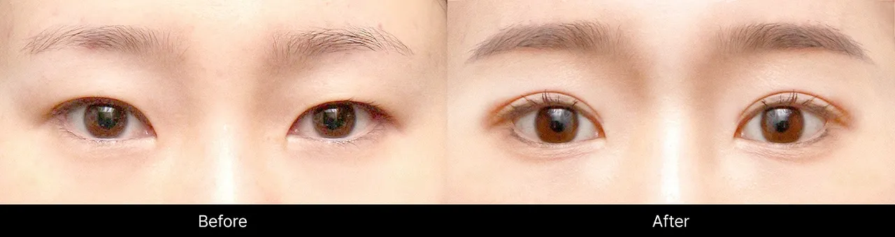 Before and after procedure images