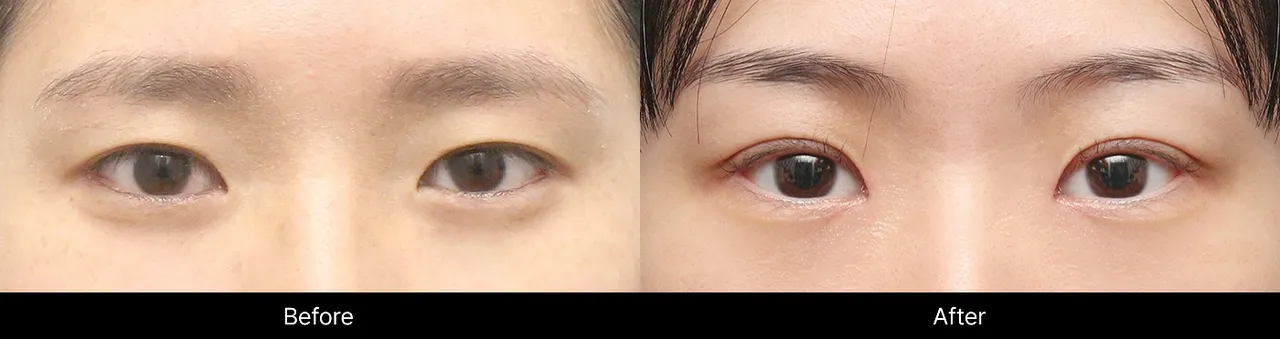 Before-and-after procedure images