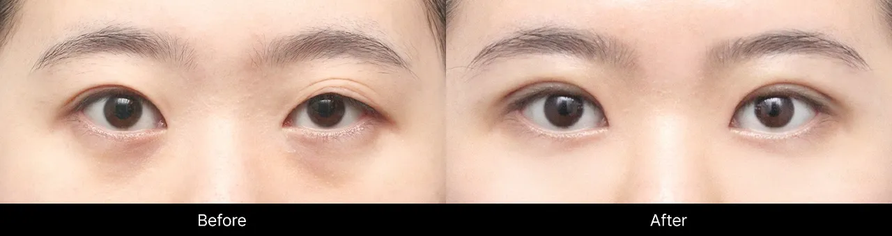 Before and after procedure images