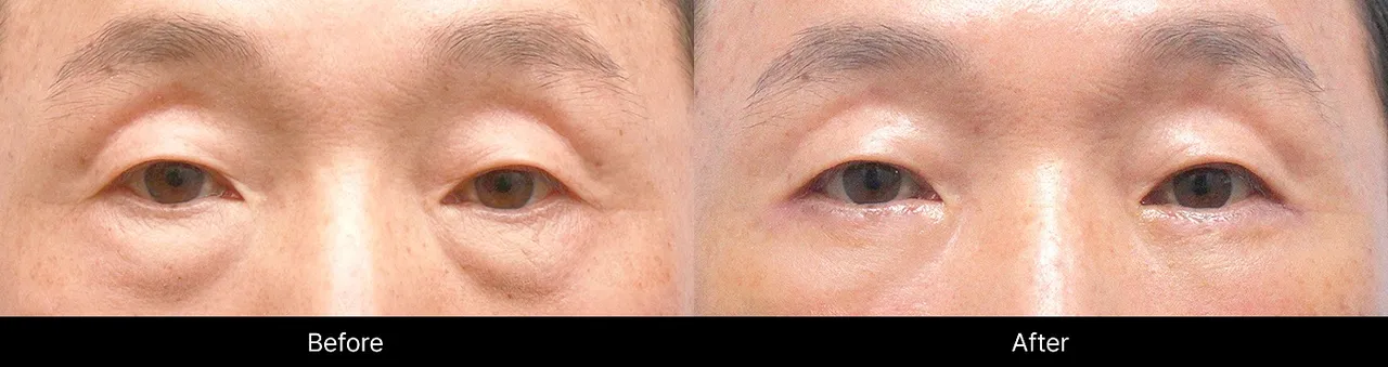 Before and after images