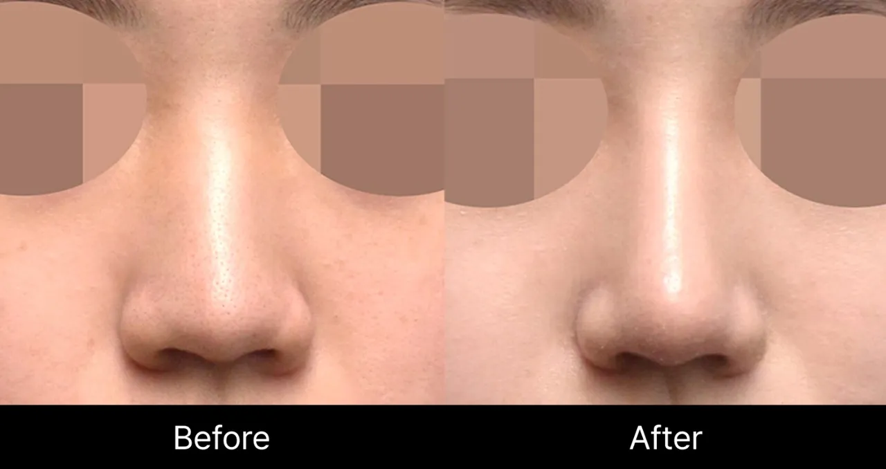 Before and after image 1