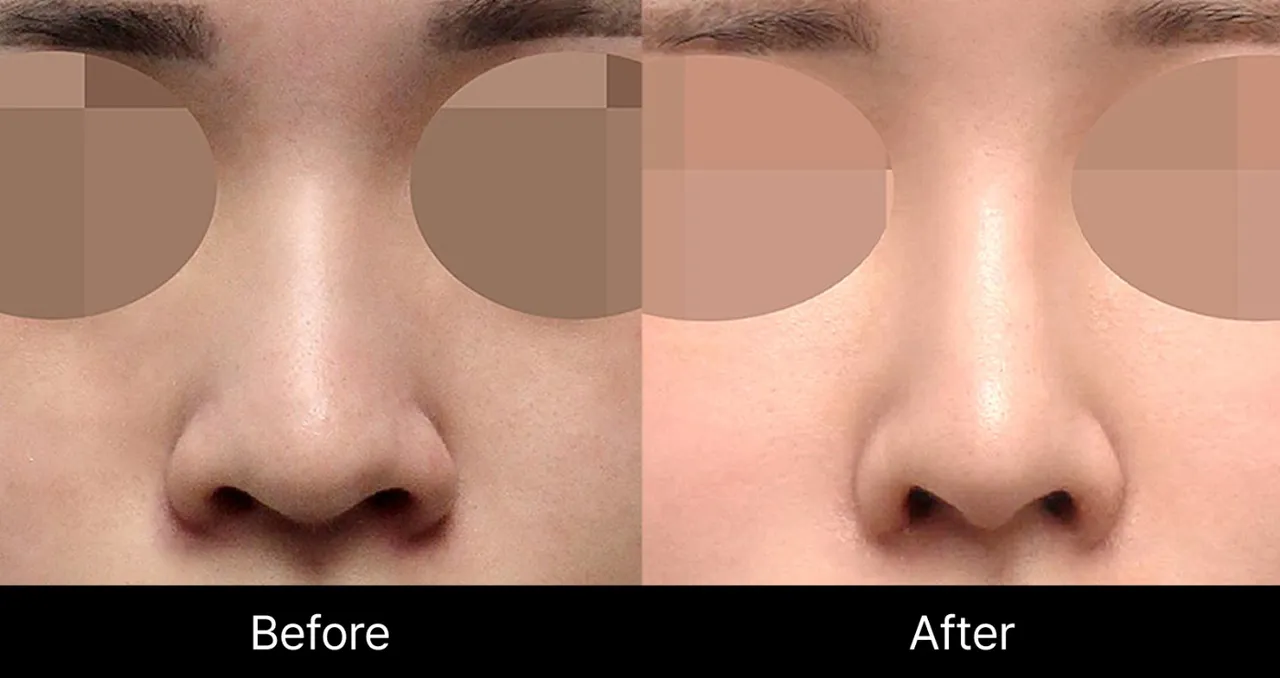 Before and after image 2