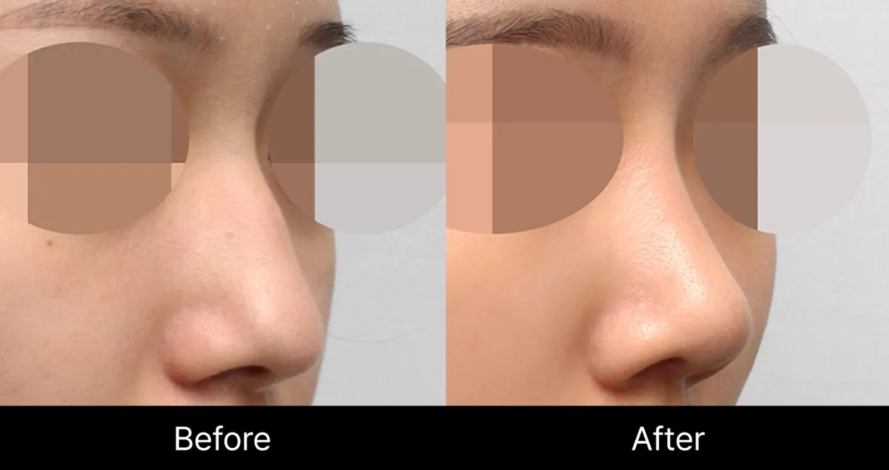 Before-and-after images