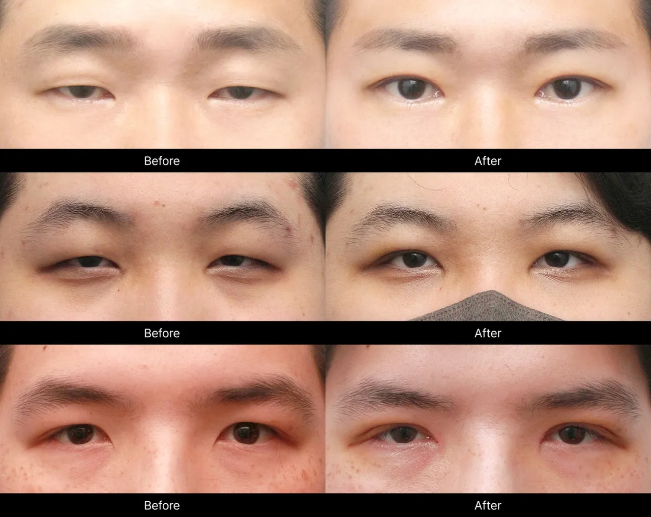 Before-and-after procedure images