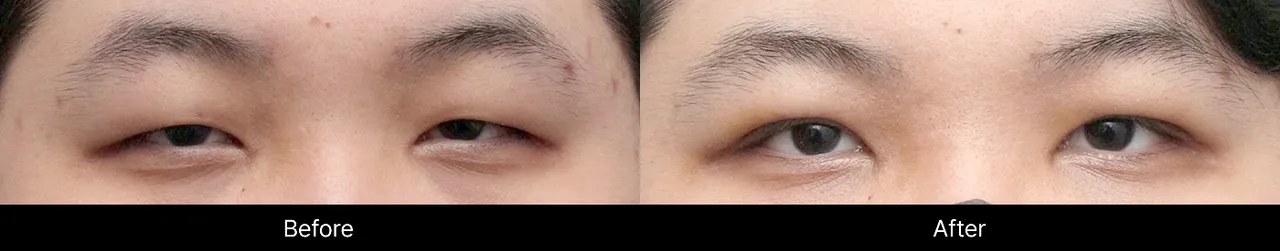 Before-and-after procedure images
