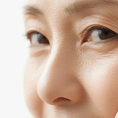 Forehead Lift
