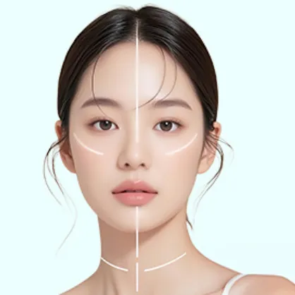 Dermal Fillers