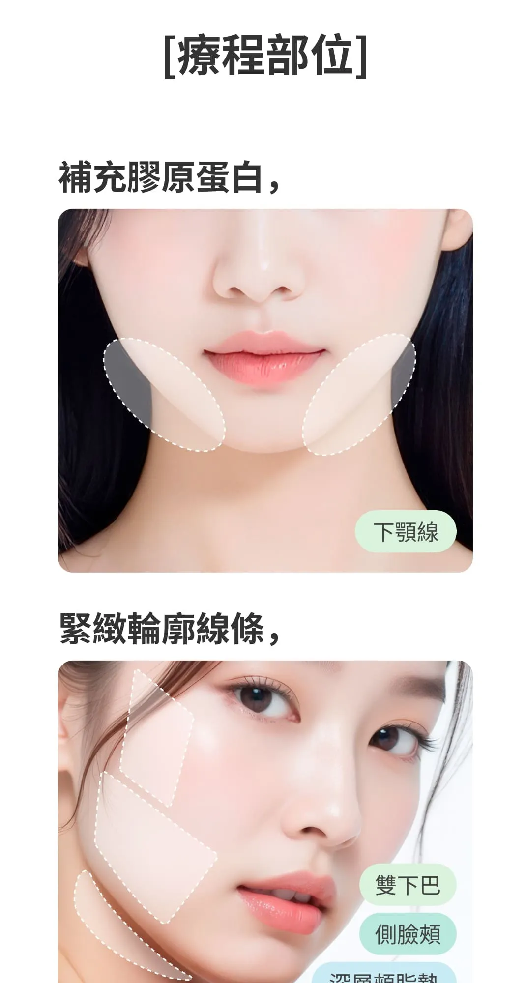 번1 (6/7)