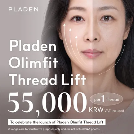 Full-Face Thread lift