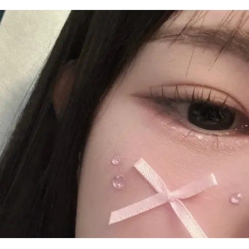 Non-incisional double eyelid surgery, Epicanthoplasty 1