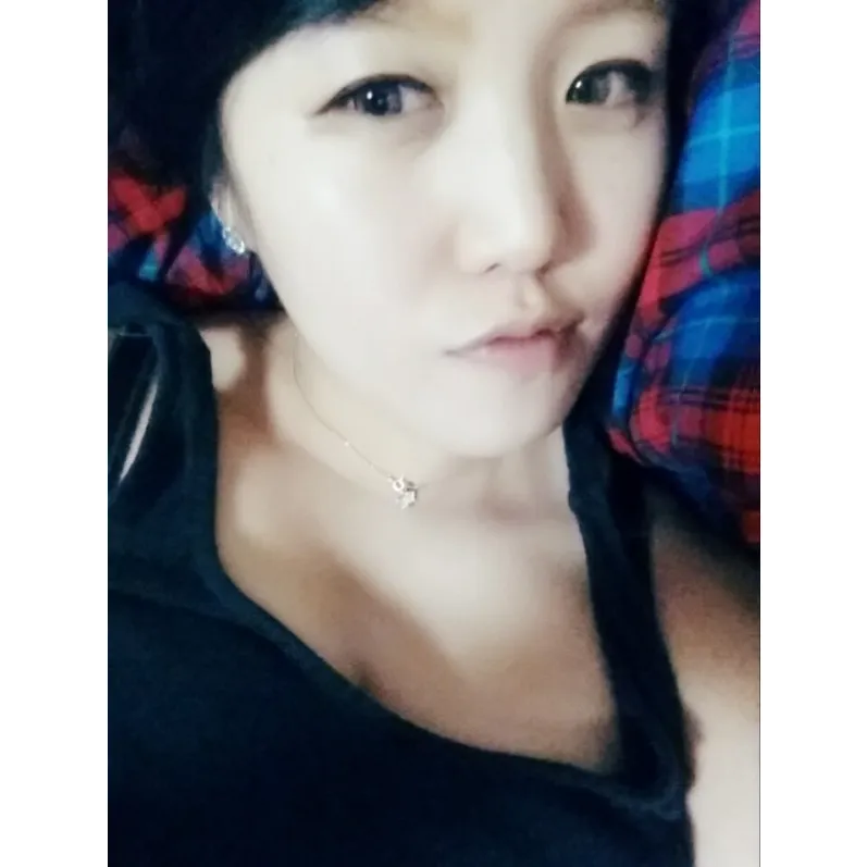 Incisional Double Eyelid Surgery 2
