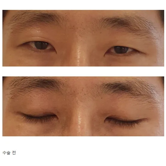 Cases — Afternoon Plastic Surgery 1