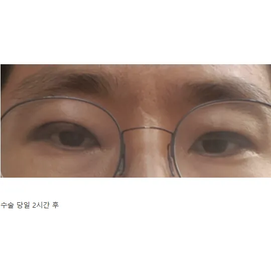 Cases — Afternoon Plastic Surgery 2