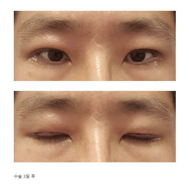 Cases — Afternoon Plastic Surgery 3