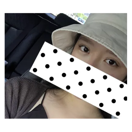 Non-incisional double eyelid surgery 2