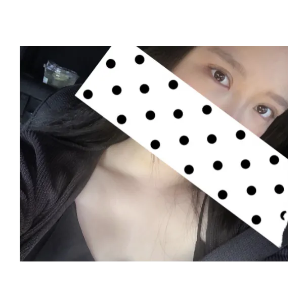 Non-incisional double eyelid surgery, Lower Eyelid Fat Repositioning — Afternoon Plastic Surgery 3