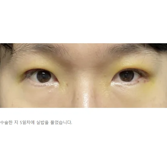 Cases — Afternoon Plastic Surgery 3