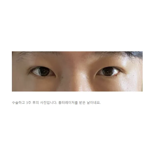 Cases — Afternoon Plastic Surgery 4