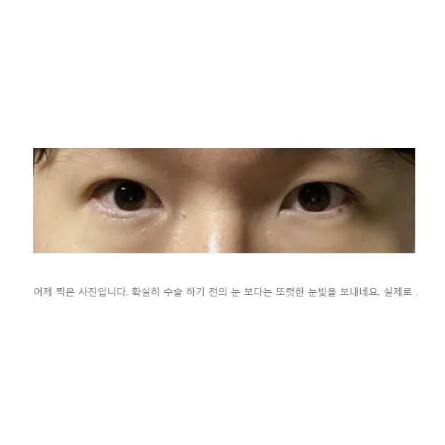 Cases — Afternoon Plastic Surgery 5