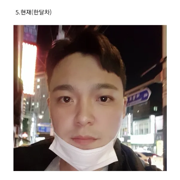 Ptosis Correction — Afternoon Plastic Surgery 3