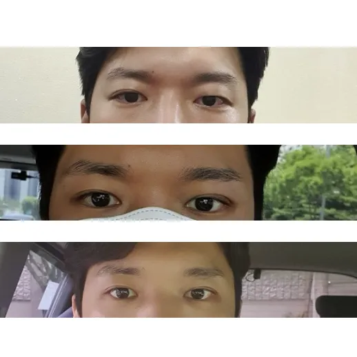 Cases — Afternoon Plastic Surgery 1