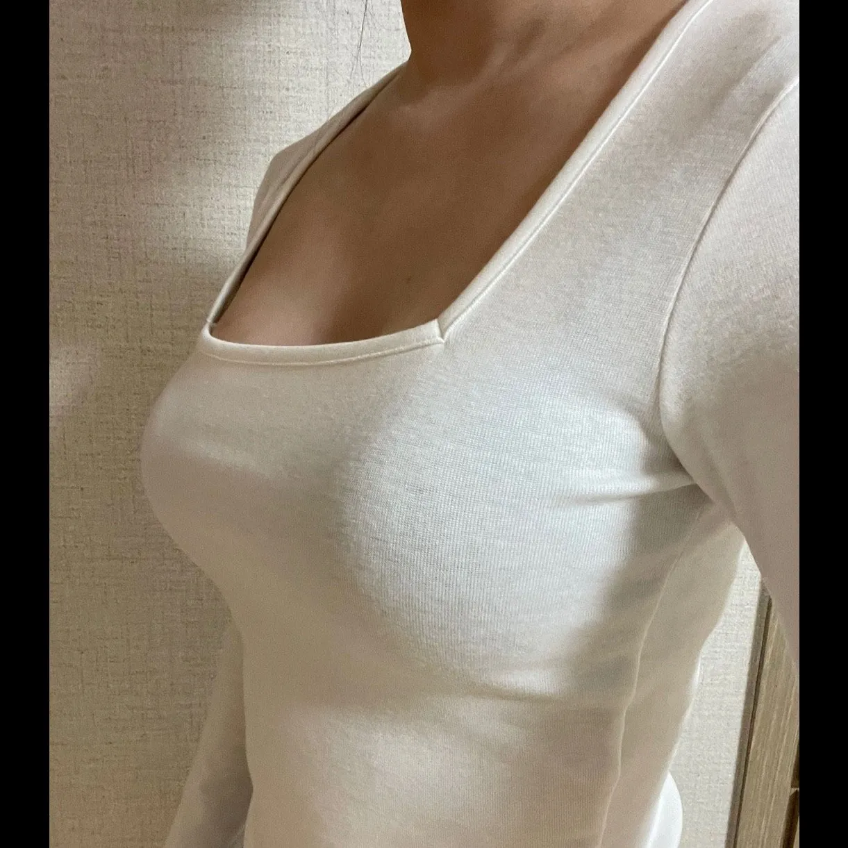 Mentor Implant — AMORATA PLASTIC SURGERY 5