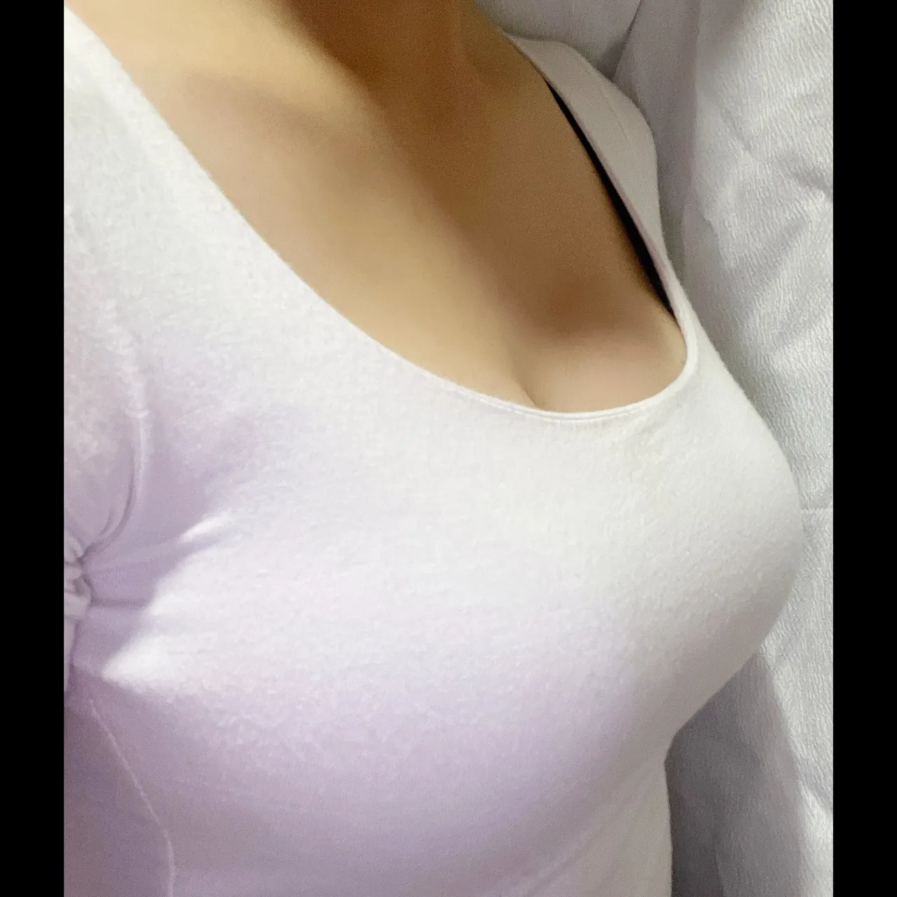 Mentor Implant, Hybrid Fat Grafting — AMORATA PLASTIC SURGERY 5