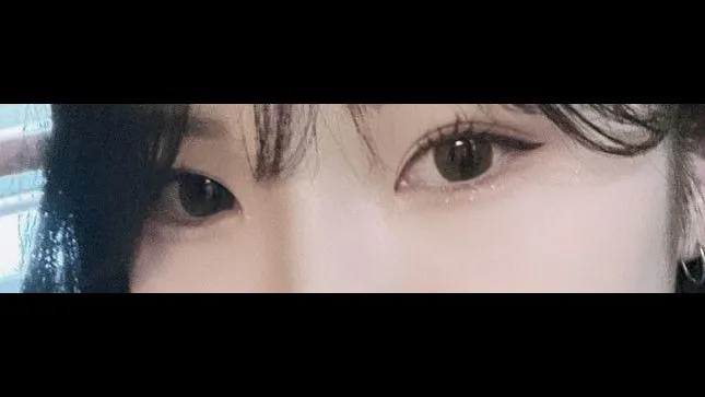 Incisional Double Eyelid Surgery, Ptosis Correction — RE&RE PLASTIC SURGERY 3