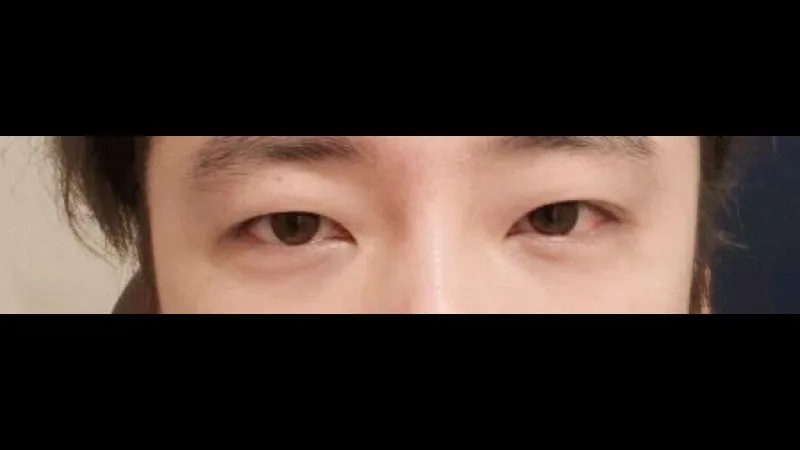 Cases — RE&RE PLASTIC SURGERY 1